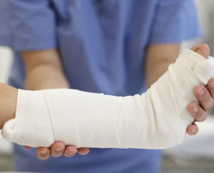 fracture-1000